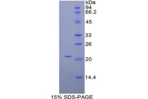 SDS-PAGE analysis of Mouse HDGF Protein. (HDGF Protéine)