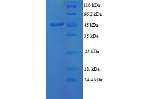 SDS-PAGE (SDS) image for Matrix Metallopeptidase 3 (Stromelysin 1, Progelatinase) (MMP3) (AA 104-477) protein (His tag) (ABIN5713094)