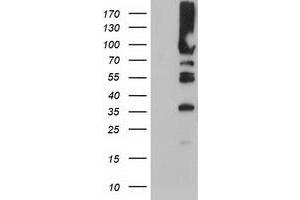 Western Blotting (WB) image for anti-phosphofructokinase, Platelet (PFKP) antibody (ABIN1500161) (PFKP anticorps)