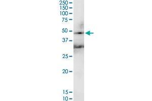 HAVCR1 MaxPab rabbit polyclonal antibody.