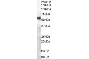 ABIN185563 (1µg/ml) staining of Human Lymph Node lysate (35µg protein in RIPA buffer).
