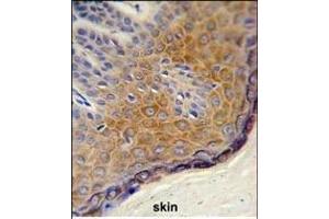 Formalin-fixed and paraffin-embedded human skin reacted with DERA Antibody (N-term), which was peroxidase-conjugated to the secondary antibody, followed by DAB staining. (DERA anticorps  (N-Term))