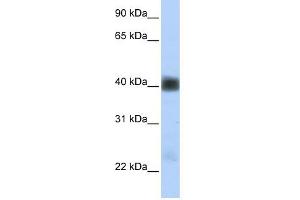 SGCB antibody used at 1 ug/ml to detect target protein. (SGCB anticorps)