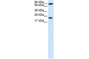 WB Suggested Anti-CBX5 Antibody Titration:  1. (CBX5 anticorps  (Middle Region))
