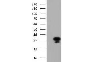 Western Blotting (WB) image for anti-Adenylate Kinase 3 (AK3) antibody (ABIN1496523) (Adenylate Kinase 3 anticorps)