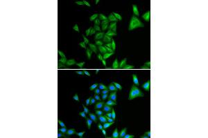 Immunofluorescence (IF) image for anti-Phytanoyl-CoA 2-Hydroxylase (PHYH) antibody (ABIN1980320) (PHYH anticorps)