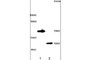 Lane 1: rat brain lysates Lane 2: rat lung lysates probed with Anti ADCY5 Polyclonal Antibody, unconjugated (ABIN751183) at 1:200 in 4 °C Followed by conjugation to secondary antibody (ABIN727474-HRP) at 1:3000 90min in 37 °C Predicted band 139kD. (ADCY5 anticorps  (AA 857-909))