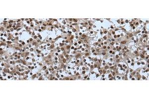 Immunohistochemistry of paraffin-embedded Human tonsil tissue using CELF5 Polyclonal Antibody at dilution of 1:65(x200) (CELF5 anticorps)