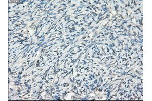 Immunohistochemical staining of paraffin-embedded colon tissue using anti-FCGR2A mouse monoclonal antibody. (FCGR2A anticorps)