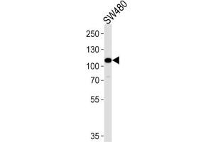 Western Blotting (WB) image for anti-Mitogen-Activated Protein Kinase Kinase Kinase 9 (MAP3K9) antibody (ABIN3003606) (MAP3K9 anticorps)