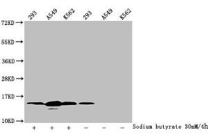 Western Blot Detected samples: 293 whole cell lysate, A549 whole cell lysate, K562 whole cell lysate, Untreated (-) or treated (+) with 30 mM sodium butyrate for 4h All lanes: HIST1H2BC antibody at 1:100 Secondary Goat polyclonal to rabbit IgG at 1/50000 dilution Predicted band size: 14 kDa Observed band size: 14 kDa (Histone H2B anticorps  (acLys12))