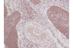 Image no. 1 for anti-Colony Stimulating Factor 2 (Granulocyte-Macrophage) (CSF2) antibody (ABIN465582) (GM-CSF anticorps)