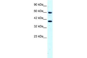WB Suggested Anti-RORA Antibody Titration:  4. (RORA anticorps  (N-Term))