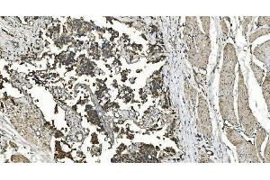 IHC analysis of FLCN using anti-FLCN antibody (ABIN7602491). (FLCN anticorps  (AA 8-551))
