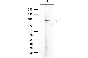 Western blot analysis of lysates from Rat brain, using Phospho-PS (Ser295) Antibody at 1/1000 dilution.