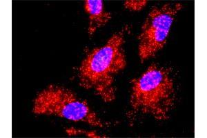 Proximity Ligation Analysis of protein-protein interactions between IKBKB and TRAF2.