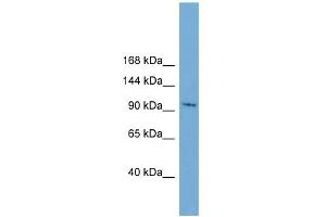 WB Suggested Anti-STK31 Antibody Titration:  0. (STK31 anticorps  (N-Term))