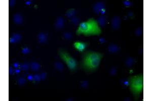 Image no. 2 for anti-Aldehyde Dehydrogenase 3 Family, Member A1 (ALDH3A1) antibody (ABIN1496591) (ALDH3A1 anticorps)