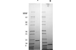 SDS-PAGE of Human Resistin Dimer Recombinant Protein SDS-PAGE of Human Resistin Dimer Recombinant Protein. (Resistin Dimer Protéine)