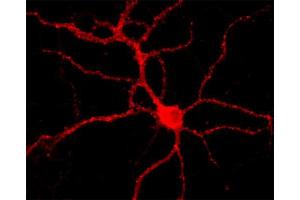 Immunofluorescence labeling of a hippocampus neuron (dilution 1 : 1000).