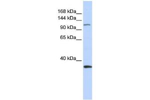 WB Suggested Anti-MCM2 Antibody Titration:  0. (MCM2 anticorps  (Middle Region))