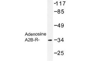 Image no. 1 for anti-Adenosine A2b Receptor (ADORA2B) antibody (ABIN317695) (Adenosine A2b Receptor anticorps)