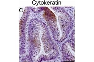 Immunohistochemical staining of tumor biopsy and biopsy spheroid sections. (KRT20 anticorps)