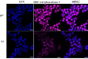 Immunocytochemical staining of Hela cells using DNA methyltransferase 1 antibody (ABIN7798362), 1:1,000), Top panel: wild-type (WT), Bottom panal: DNA methyltransferase 1 shRNA knockdown (KD). (Recombinant DNMT1 anticorps)