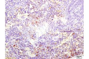 Formalin-fixed and paraffin embedded mouse spleen labeled with Rabbit Anti Kinesin3 Polyclonal Antibody, Unconjugated  at 1:200 followed by conjugation to the secondary antibody and DAB staining (Kinesin anticorps  (AA 561-660))