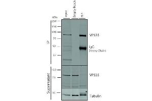 Immunoprecipitation analysis using Mouse Anti-VPS35 Monoclonal Antibody, Clone 7E4 (ABIN6932909). (VPS35 anticorps  (Atto 390))