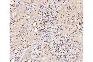 ABIN6267404 at 1/200 staining human kidney tissue sections by IHC-P. (Stathmin 1 anticorps  (pSer15))