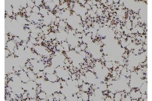 ABIN6261837 and ABIN6269100 at 1/100 staining Mouse lung tissue by IHC-P. (FYN anticorps  (C-Term))