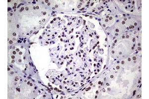 Image no. 15 for anti-Nibrin (NBN) (AA 183-460) antibody (ABIN1491066)