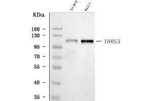 Western blot analysis of THBS3 using anti-THBS3 antibody (ABIN7600759).