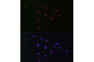 Immunofluorescence analysis of C6 cells using SOX10 Rabbit pAb (ABIN6134484, ABIN6148289 and ABIN7101829) at dilution of 1:100 (40x lens). (SOX10 anticorps)