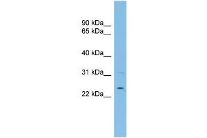 WB Suggested Anti-UBE2E3 Antibody Titration:  0. (UBE2E3 anticorps  (N-Term))