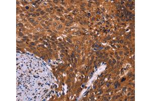 Immunohistochemistry (IHC) image for anti-CDC5 Cell Division Cycle 5-Like (S. Pombe) (CDC5L) antibody (ABIN2422862) (CDC5L anticorps)