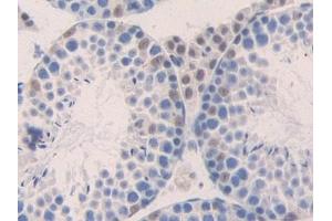 Detection of MIP1b in Mouse Testis Tissue using Polyclonal Antibody to Macrophage Inflammatory Protein 1 Beta (MIP1b) (CCL4 anticorps  (AA 24-92))