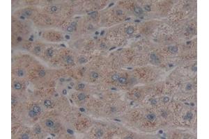 DAB staining on IHC-P; Samples: Human Liver Tissue (Neuroglobin anticorps  (AA 1-151))