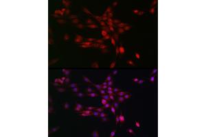Immunofluorescence analysis of PC-12 cells using PHD3 Rabbit pAb (ABIN6130355, ABIN6139990, ABIN6139991 and ABIN6224021) at dilution of 1:50 (40x lens).