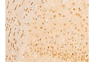 ABIN6267236 at 1/100 staining mouse brain tissue sections by IHC-P. (MAP3K7 anticorps  (pThr187))