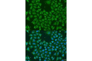 Immunofluorescence analysis of U2OS cells using AKR7A3 antibody. (AKR7A3 anticorps  (AA 1-331))