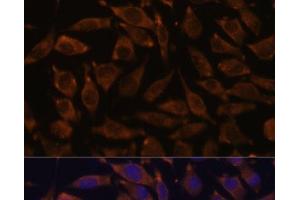 Immunofluorescence analysis of L929 cells using NOTCH2 Polyclonal Antibody at dilution of 1:100. (NOTCH2 anticorps)