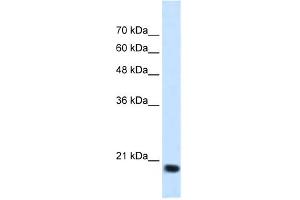 WB Suggested Anti-SSR2 Antibody Titration:  1. (SSR2 anticorps  (N-Term))
