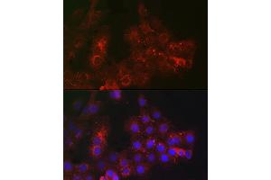 Immunofluorescence analysis of  cells using TROP-2 Rabbit pAb (ABIN7271104) at dilution of 1:100 (40x lens). (TACSTD2 anticorps  (AA 27-270))