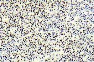 Immunohistochemistry (IHC) analyzes of p-Histone H3. (Histone H3.1 anticorps  (pThr3))