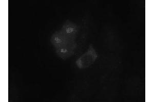 Image no. 1 for anti-Budding Uninhibited By Benzimidazoles 1 Homolog (Yeast) (BUB1) (AA 281-419) antibody (ABIN108553) (BUB1 anticorps  (AA 281-419))