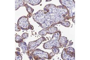 Immunohistochemical staining of human placenta with CRB2 polyclonal antibody  shows strong membranous and cytoplasmic positivity in trophoblastic cells. (CRB2 anticorps)