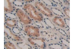 Detection of GAL3ST1 in Human Kidney Tissue using Polyclonal Antibody to Galactose-3-O-Sulfotransferase 1 (GAL3ST1)