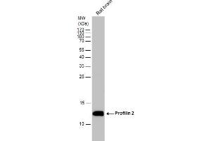 WB Image Rat tissue extract (50 μg) was separated by 15% SDS-PAGE, and the membrane was blotted with Profilin 2 antibody , diluted at 1:1000.